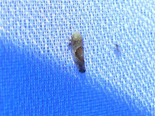 Réf. 327 328 : Hishimonus sp.